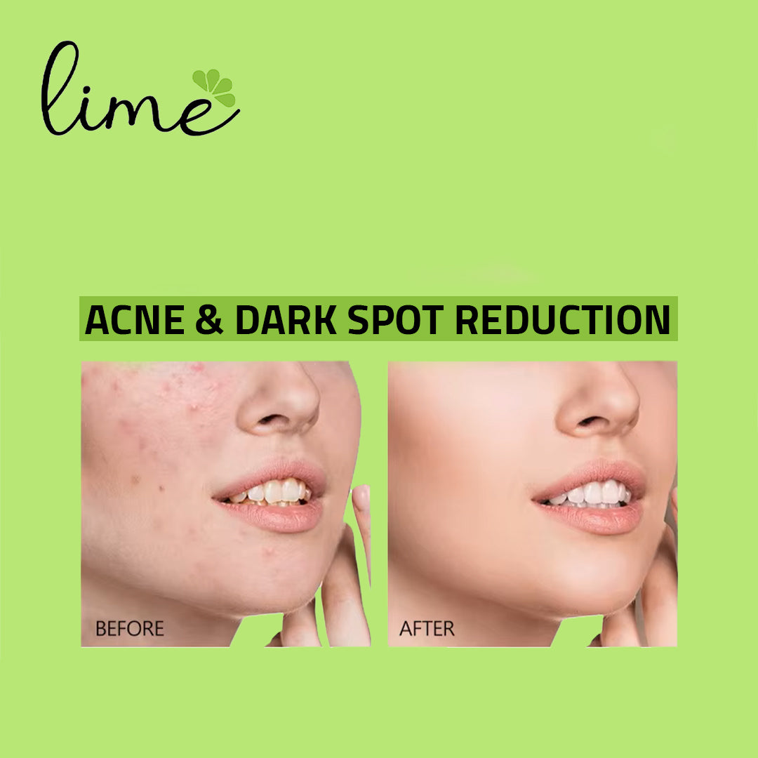 كريم مرطب ومقاوم لعلامات تقدم السن | 100 مل